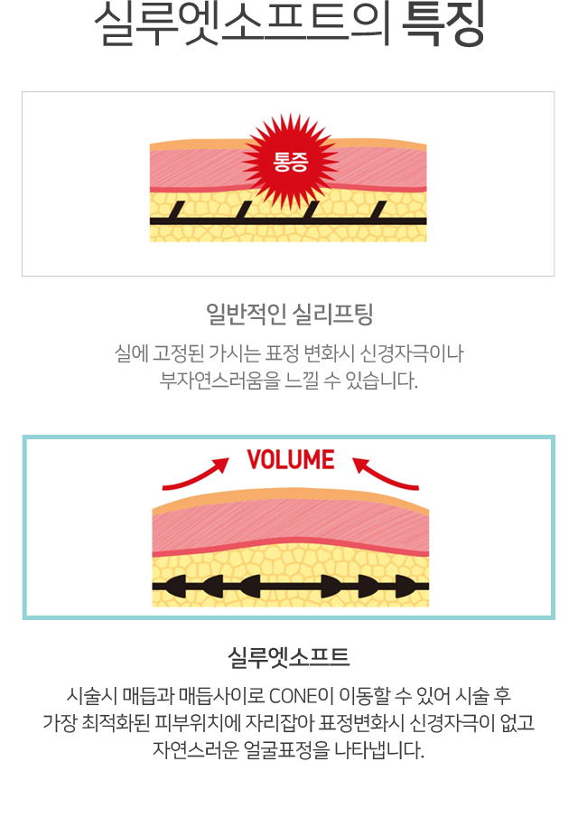 실루엣소프트