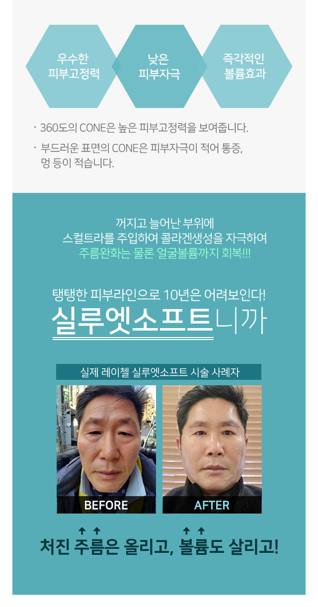 실루엣소프트