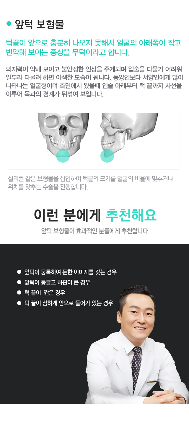 윤곽보형물