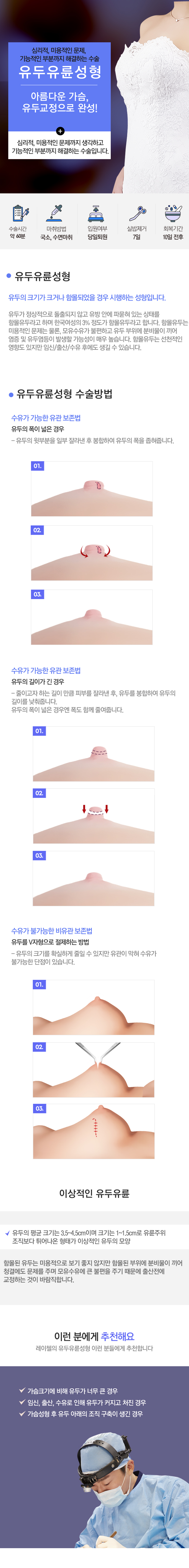 유두유륜성형